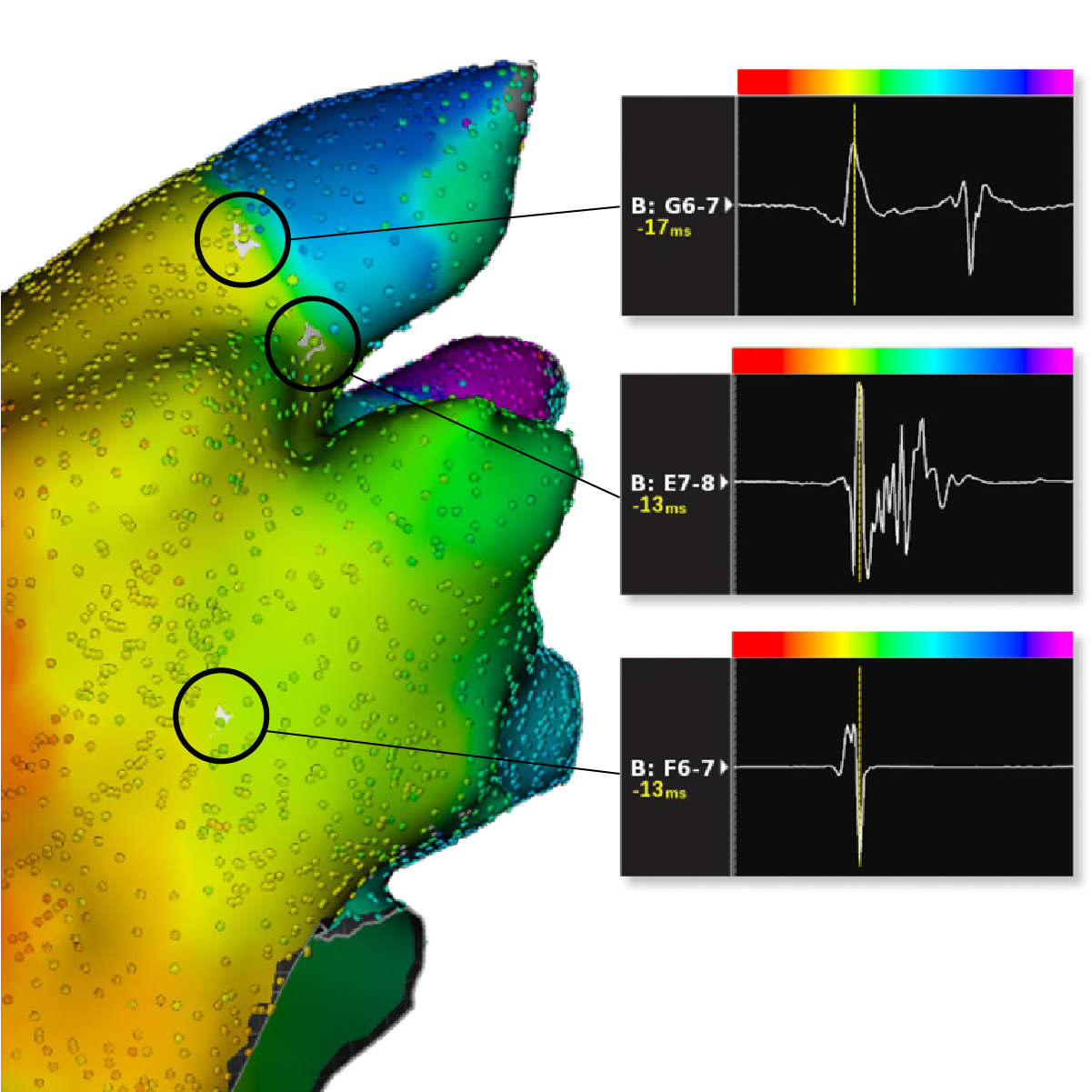 Cardiac Mapping System Software – RHYTHMIA HDx - Boston Scientific